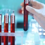 Badania krwi w Warszawie
