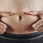 cellulit u mężczyzn