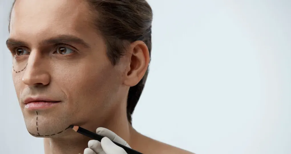 Nici do liftingu podbródka