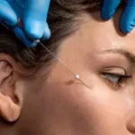 nici do podnoszenia brwi