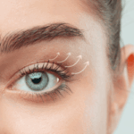 nici liftingujące powieki