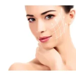 Nici unoszące – Na jakich częściach ciała nie wykonywać nici unoszących?