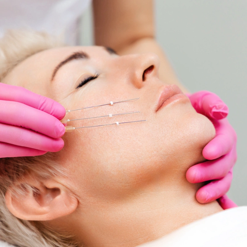 Nici liftingujące Vs Chirurgia kosmetyczna