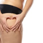 Co powoduje powstawanie cellulitu?