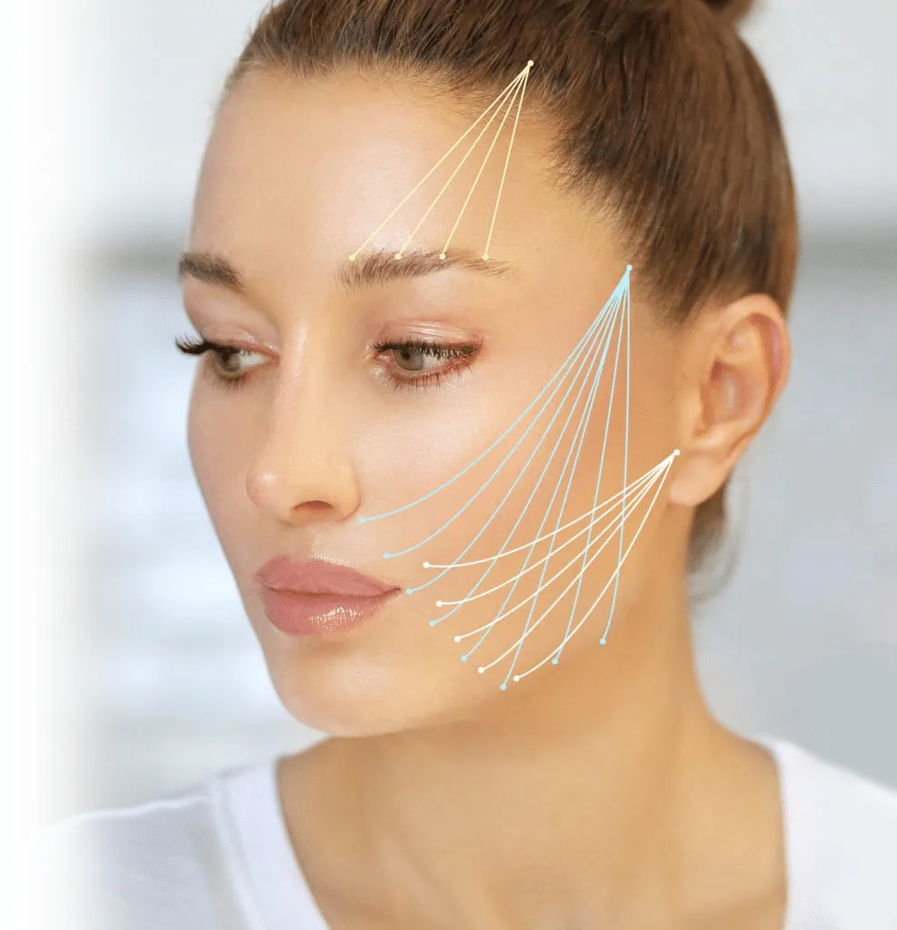 Jak wygląda zabieg z użyciem nici do liftingu czoła?